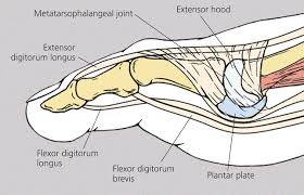 CAPSULITE infiammazione della capsula articolare dell'articolazione alla base delle dita
